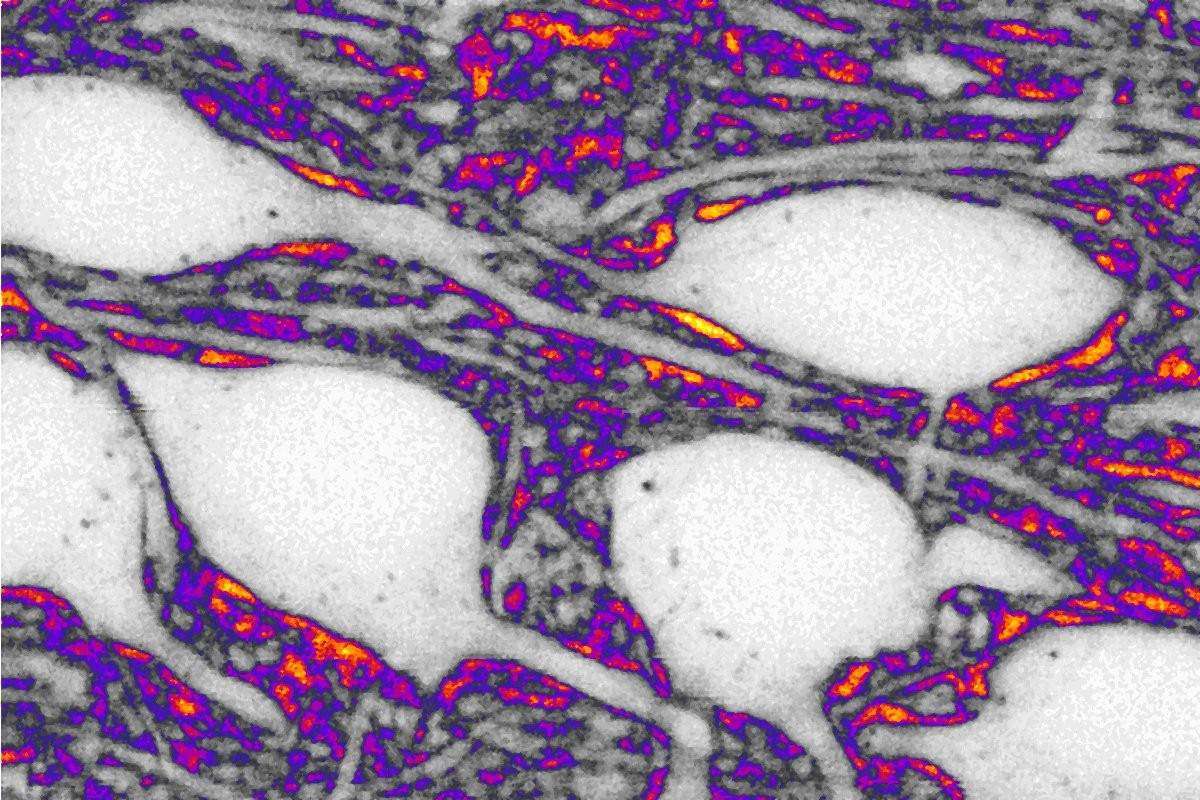 The space between neurons: a territory to explore to understand brain aging and diseases such as Parkinson's