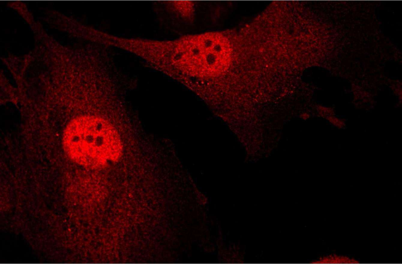 Beyond Genes: How the Physical Environment Influences Breast Cancer