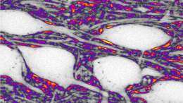 The space between neurons: a territory to explore to understand brain aging and diseases such as Parkinson's