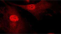 Beyond Genes: How the Physical Environment Influences Breast Cancer