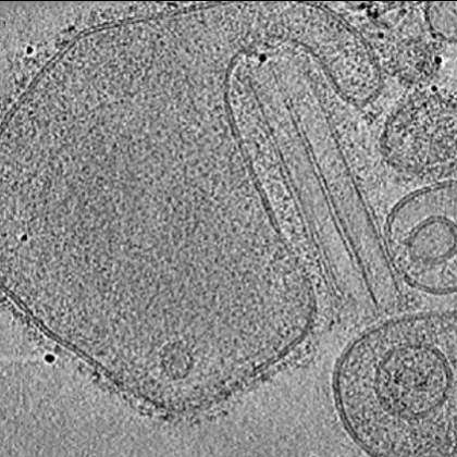 Numerical Methods of Cryo Electron Tomography Laboratory