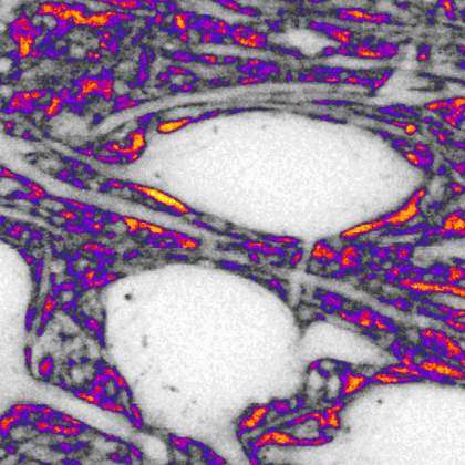 Neuronal Excitability